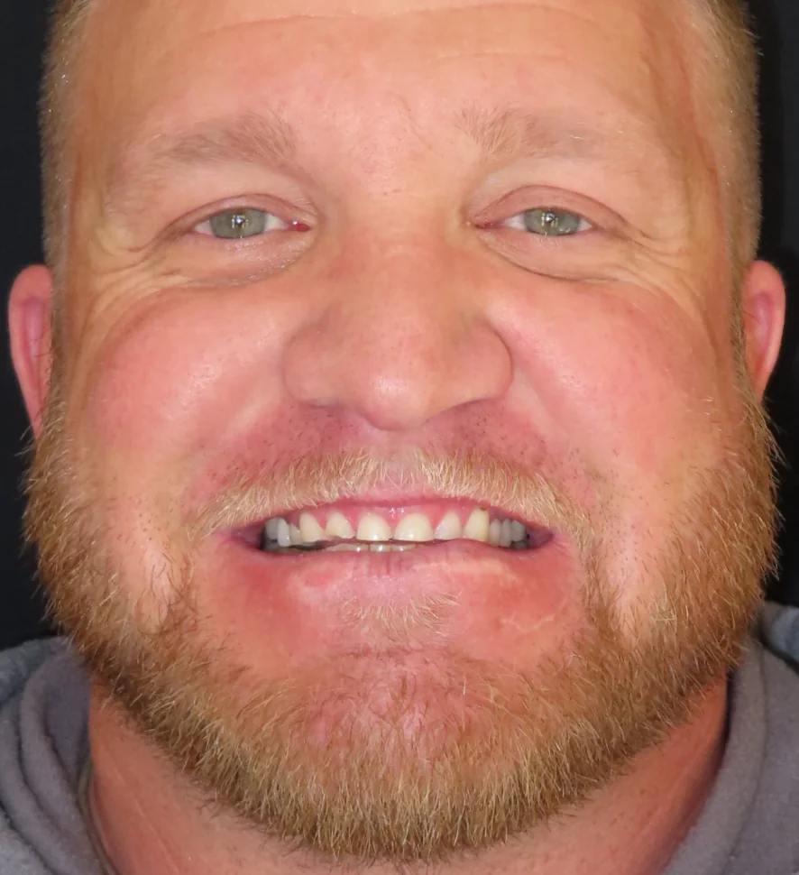 Before photo - Smile transformation case 1